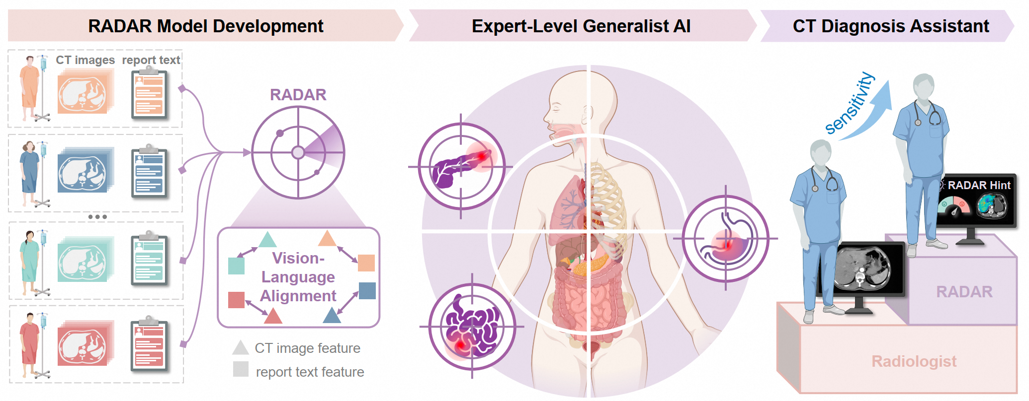 Alibaba’s DAMO RADAR Beats Most Radiologists on CT Scans